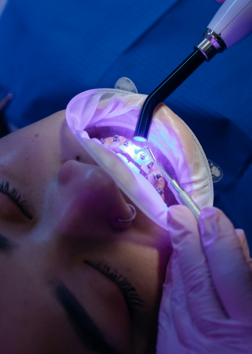 Dentures, Crowns and Bridges