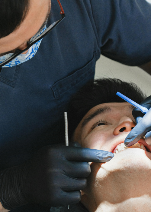Tooth Extraction